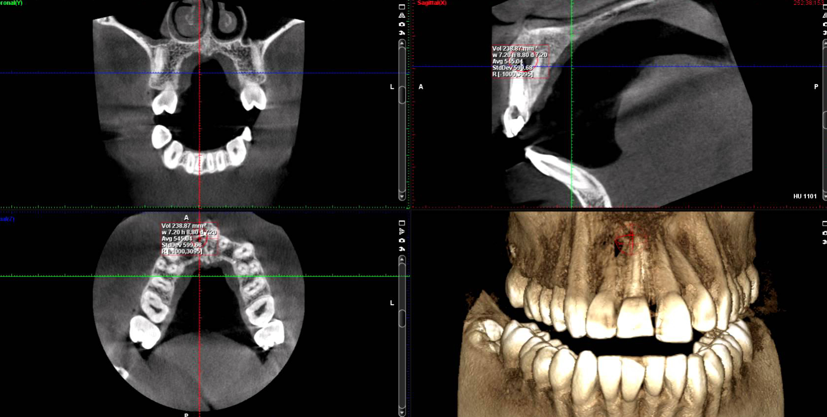 Technology Scripps Mesa Endodontics