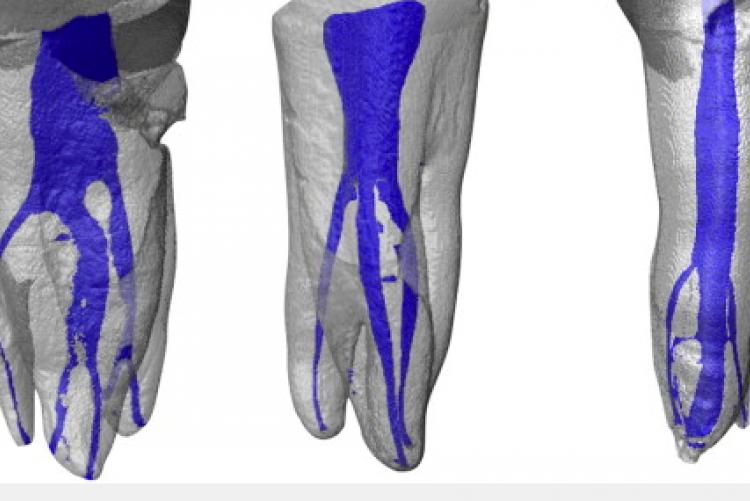 3D Imaging: Complexity of Canals