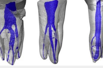 3D Imaging: Complexity of Canals