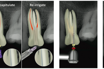 Cleaning & Shaping & Irrigation of Canals